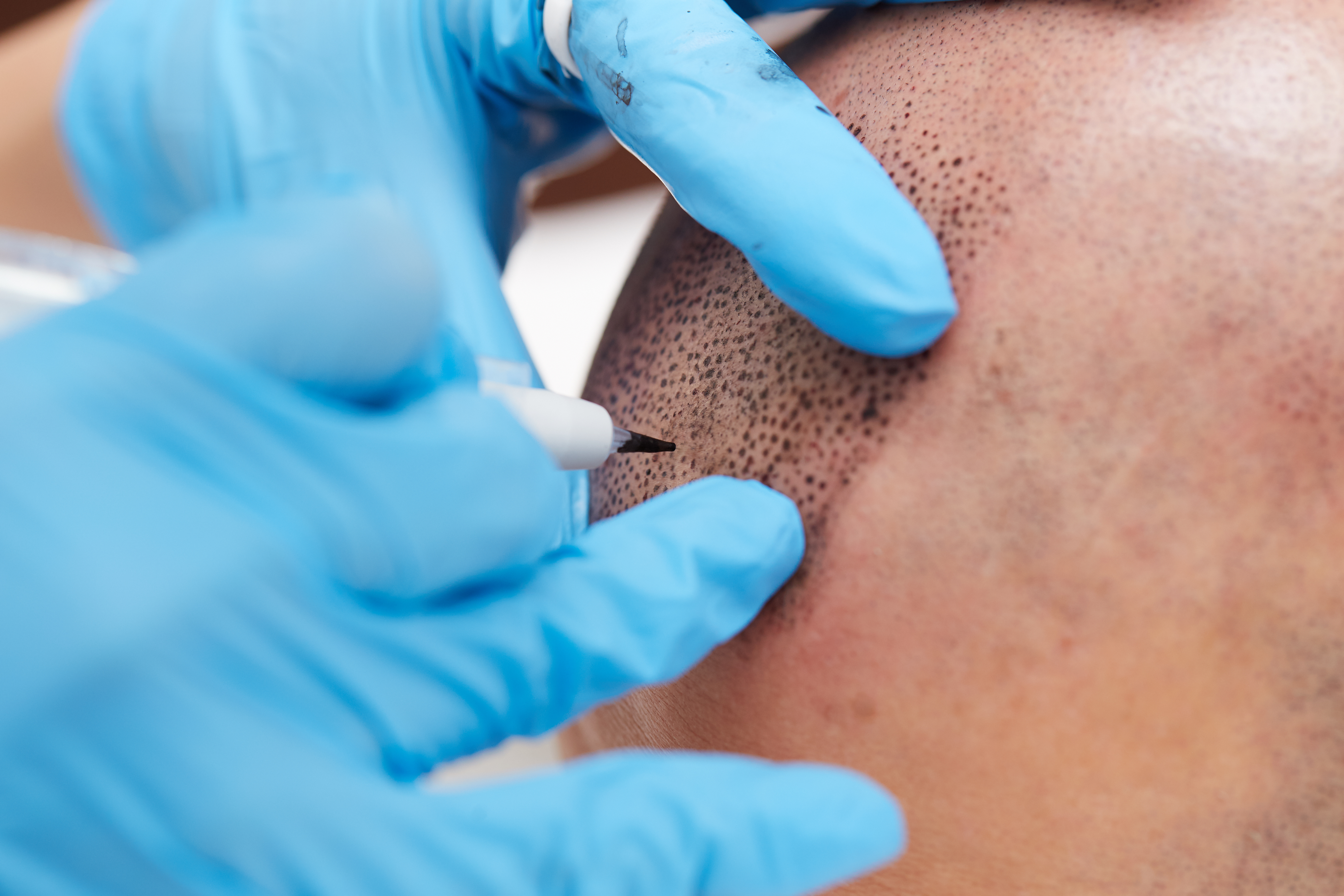 Microblading